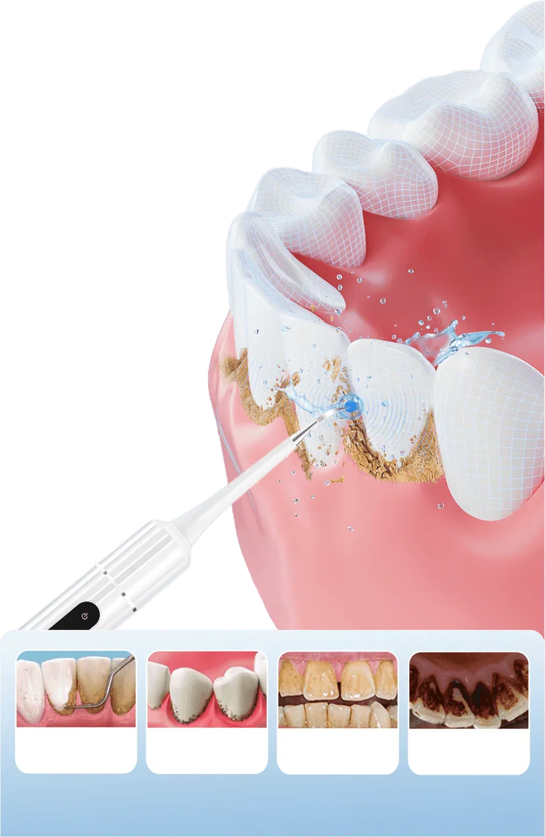 Ultrasonic Teeth Whitening Cleaner Set