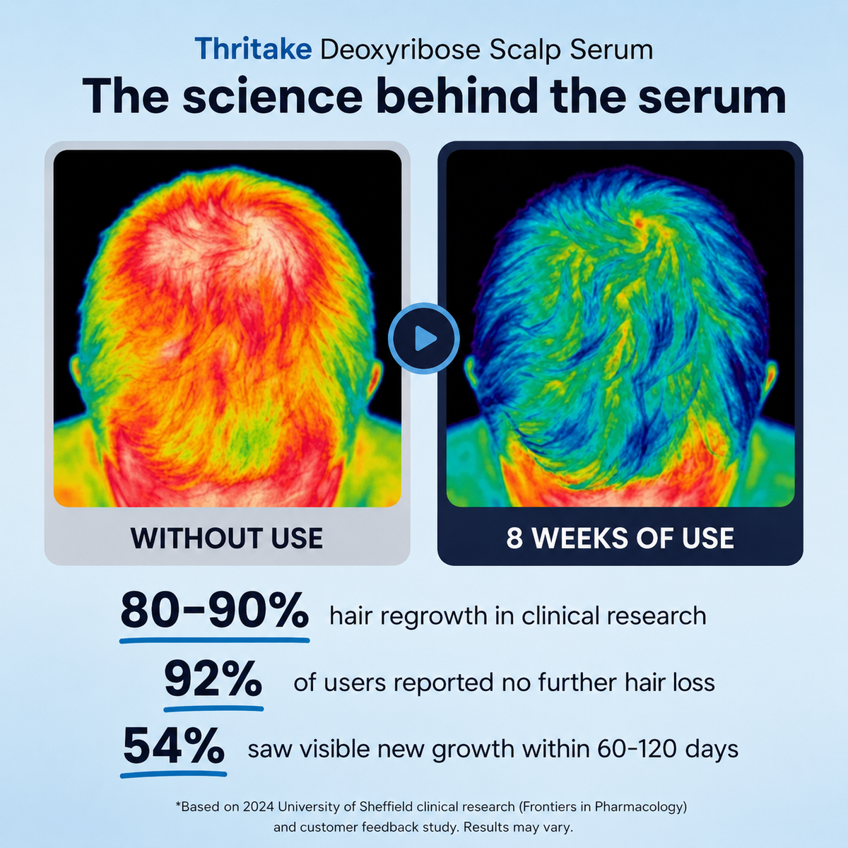 Deoxyribose Scalp Roll-On Serum with Rosemary & Caffeine
