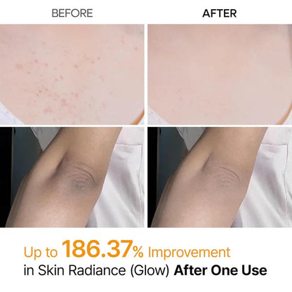 Body Peel Exfoliating Spray