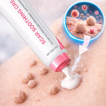 Scar Free Wart Removal Cream