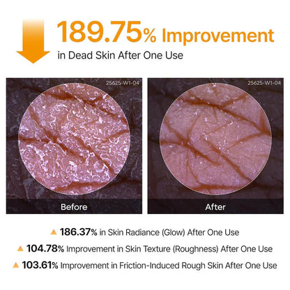 Body Peel Exfoliating Spray