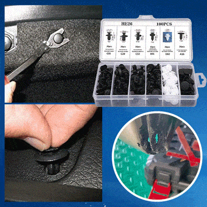 Car Fastener Box Set – Multi-Size Fasteners for Quick Vehicle Repairs