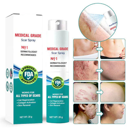 Scar Spray