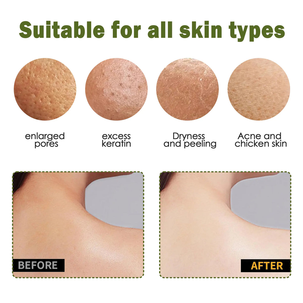 Exfoliating Gloves – Instantly Remove Dead Skin