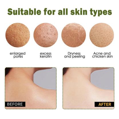 Exfoliating Gloves – Instantly Remove Dead Skin