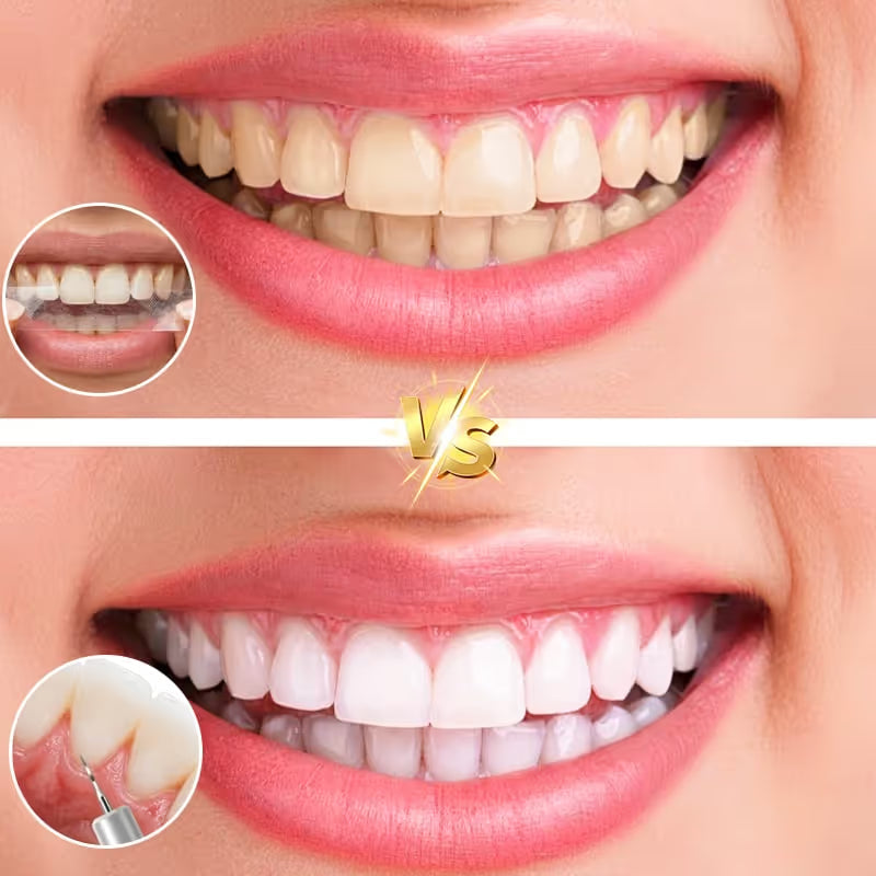 Ultrasonic Teeth Whitening Cleaner Set