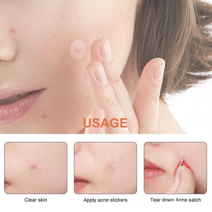 Pimple Patches