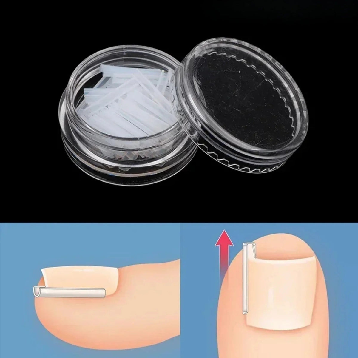 Toenail Relief Strips set