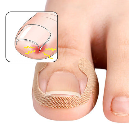 Toenail Correction Strips