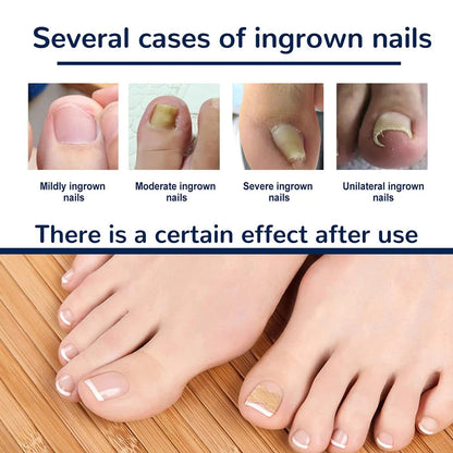 Correction patches for beautiful and healthy nails