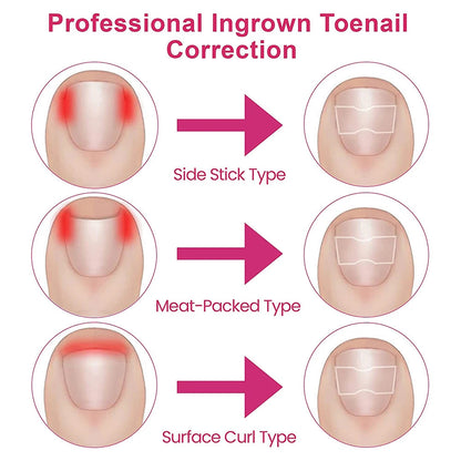 Correction patches for beautiful and healthy nails