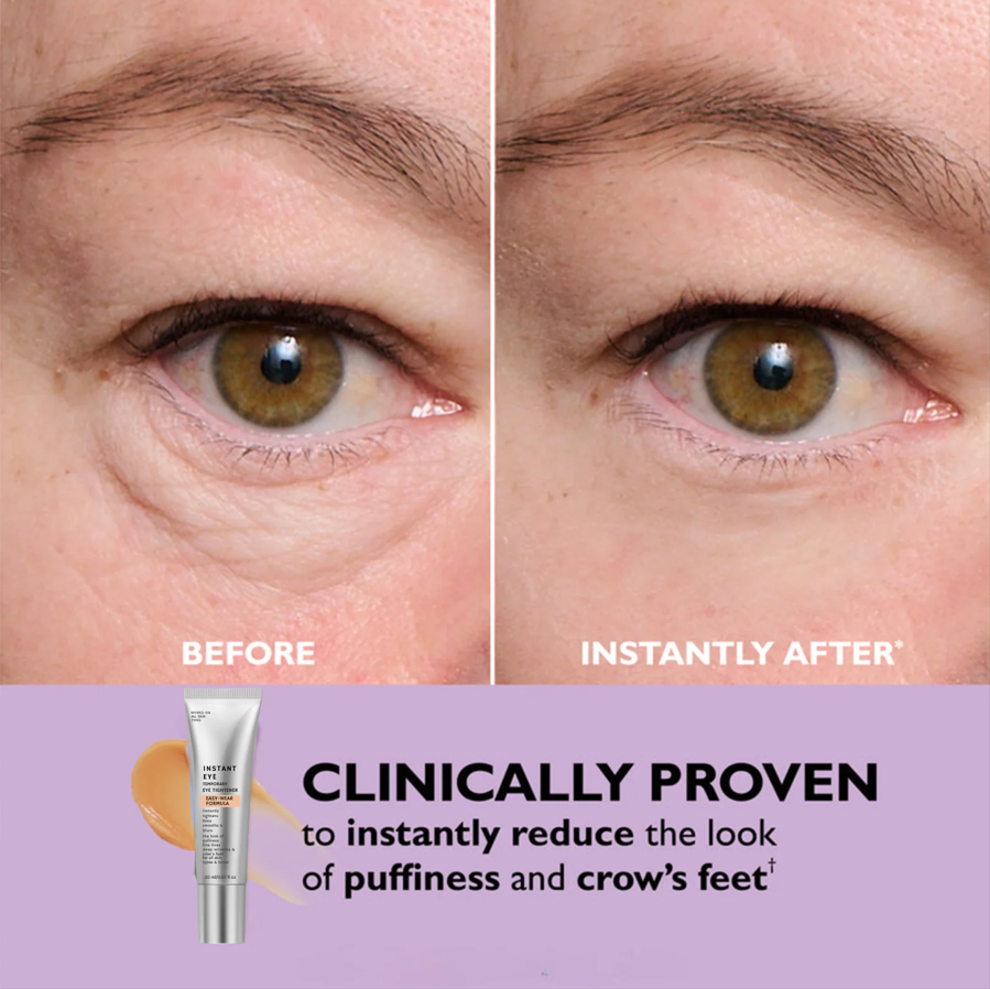 Instant Eye Tightener
