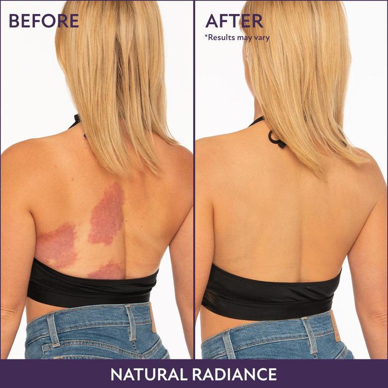 Last Day PromotionBeauty Body Coverage Perfector – Waterproof, lightweight & flawless body makeup