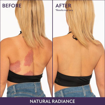 Last Day PromotionBeauty Body Coverage Perfector – Waterproof, lightweight & flawless body makeup