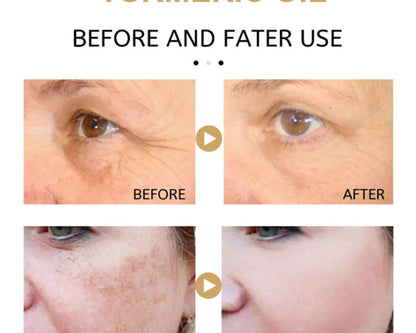 Turmeric Dark Spot Corrector Serum