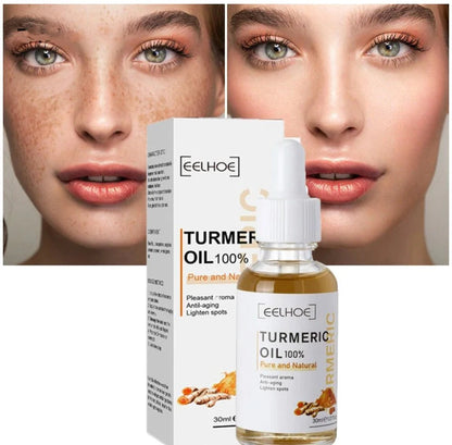 Turmeric Dark Spot Corrector Serum