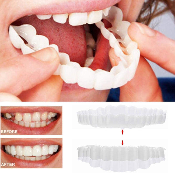 Davy | Instant Smile Veneers - Top and Bottom Included