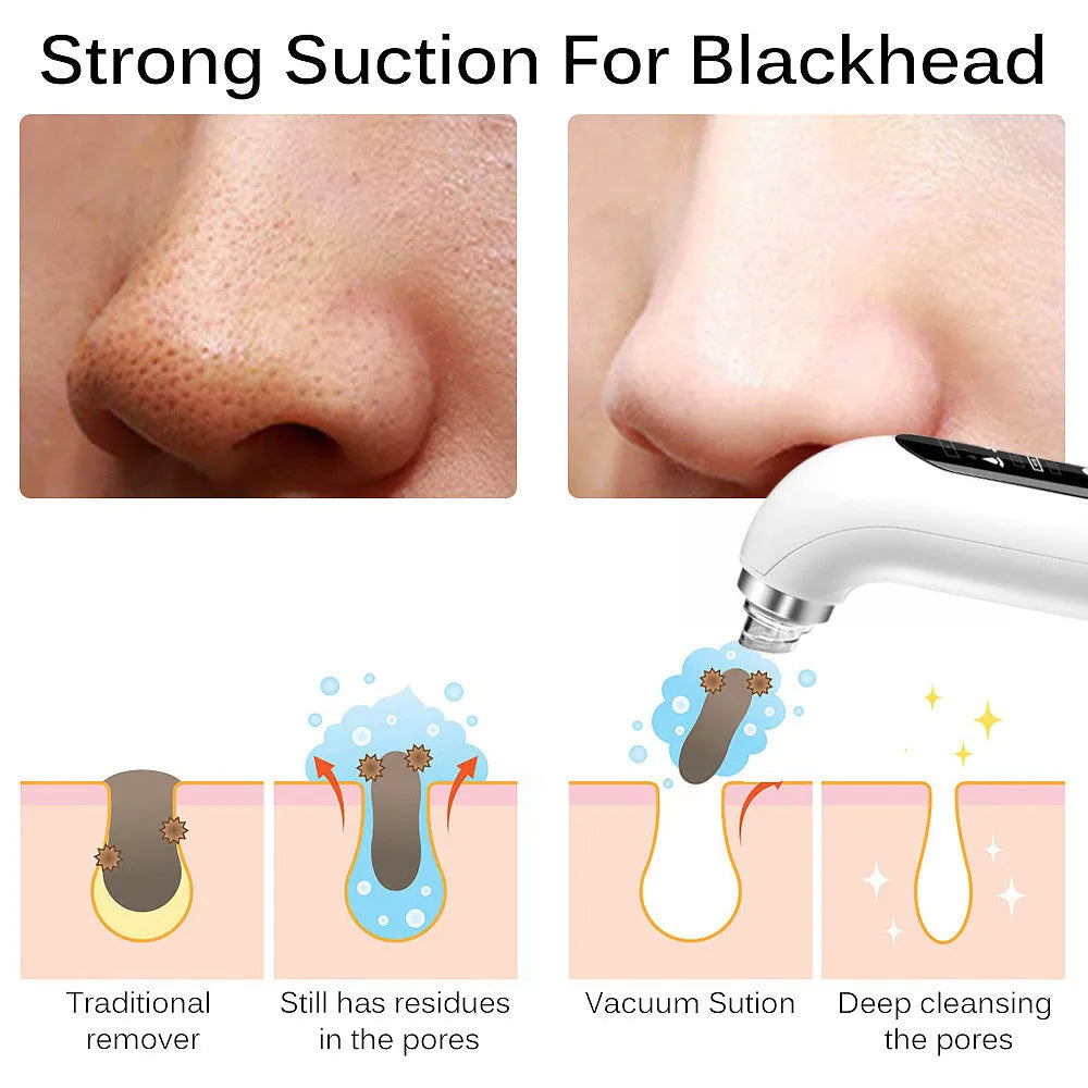 Davy | Professional Nose Blackhead Remover Vacuum - Deep Cleansing with Suction Technology