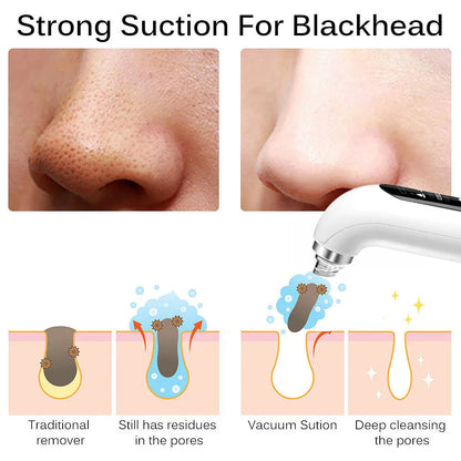 Davy | Professional Nose Blackhead Remover Vacuum - Deep Cleansing with Suction Technology