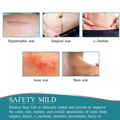 Davy | Silicone Scar Tape Roll for Scar Correction