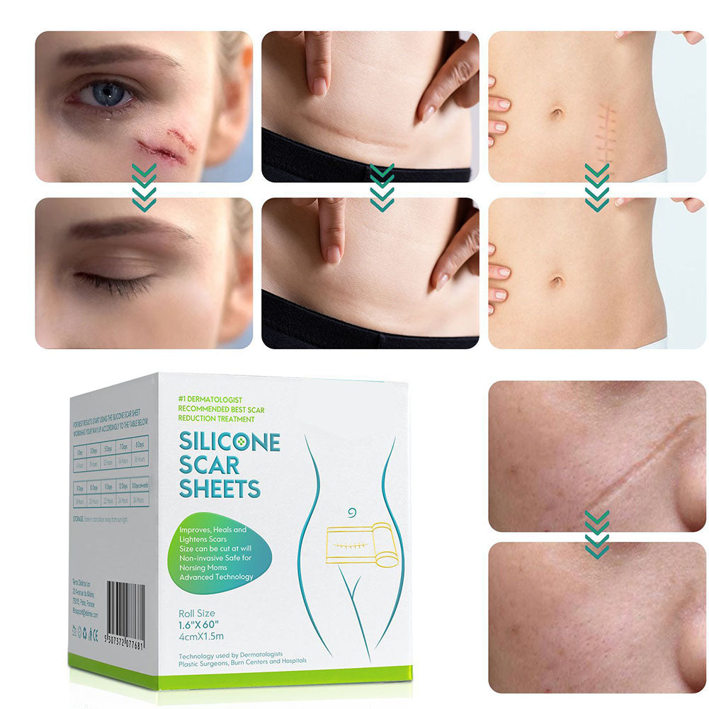 Davy | Silicone Scar Tape Roll for Scar Correction