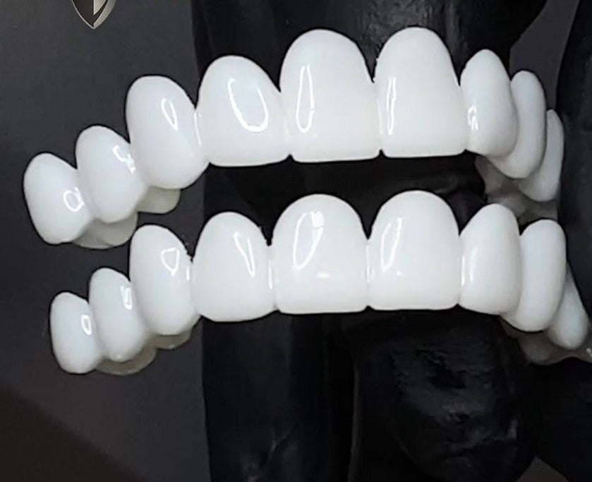Davy | Snap-On Cosmetic Veneers | Instant Smile Cover for Imperfections
