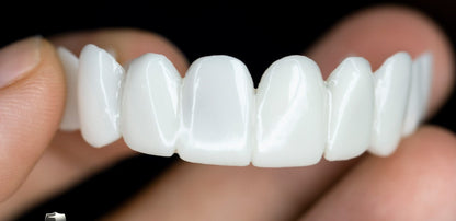 Davy | Snap-On Cosmetic Veneers | Instant Smile Cover for Imperfections