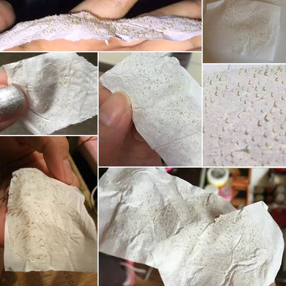 Blackhead Remover Mask