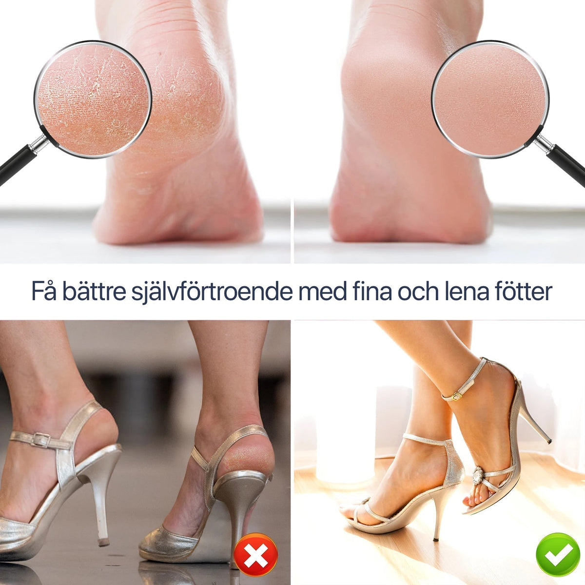 Electric Foot File for Calluses and Dry Feet