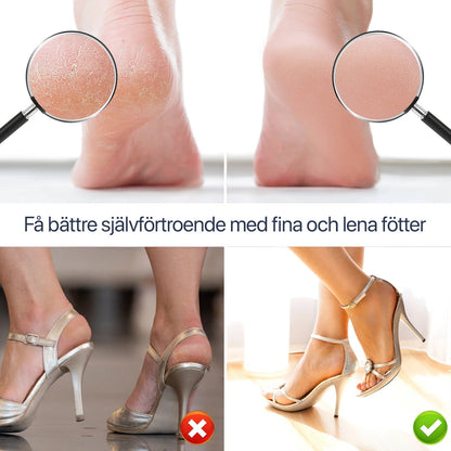 Electric Foot File for Calluses and Dry Feet