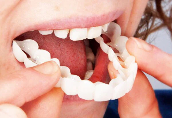 Fitflex Denture