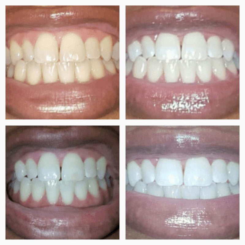 GleamRush™ Serum: Reveal a Brighter, More Confident Smile