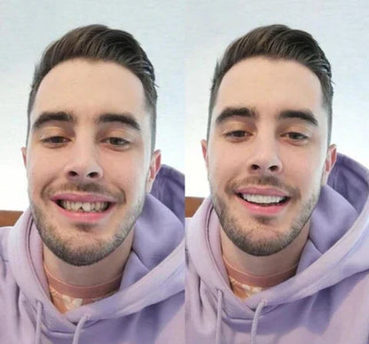 NovaBright Cosmetic Teeth Covers - Instant Smile Upgrade