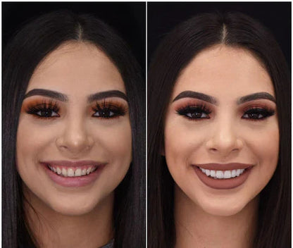 NovaBright Cosmetic Teeth Covers - Instant Smile Upgrade