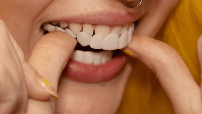 NovaBright Cosmetic Teeth Covers - Instant Smile Upgrade