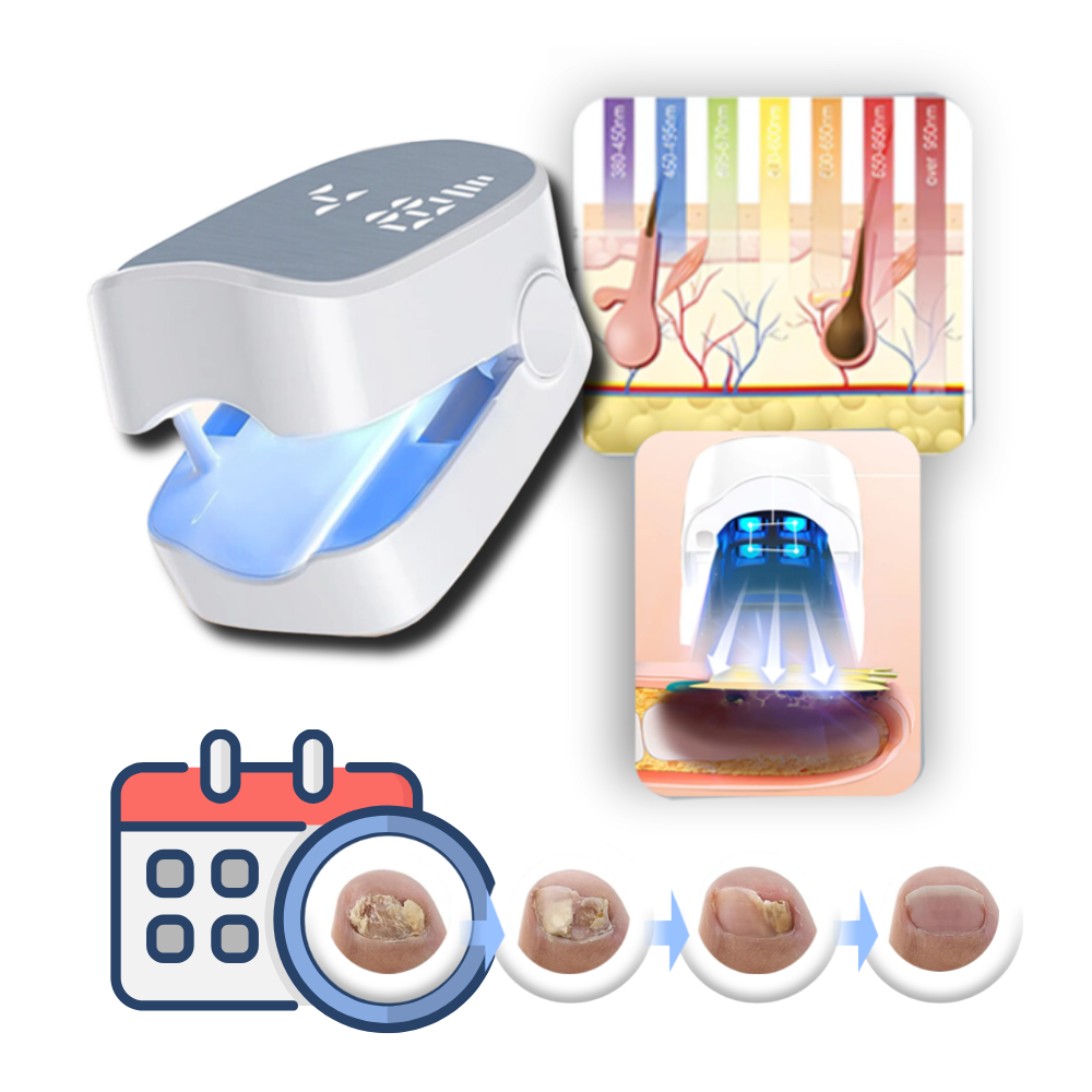 Laser Treatment Device for Nail Fungus