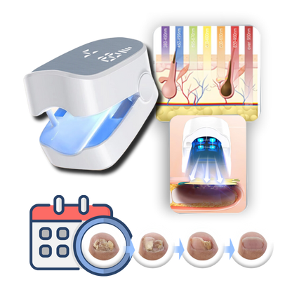 Laser Treatment Device for Nail Fungus