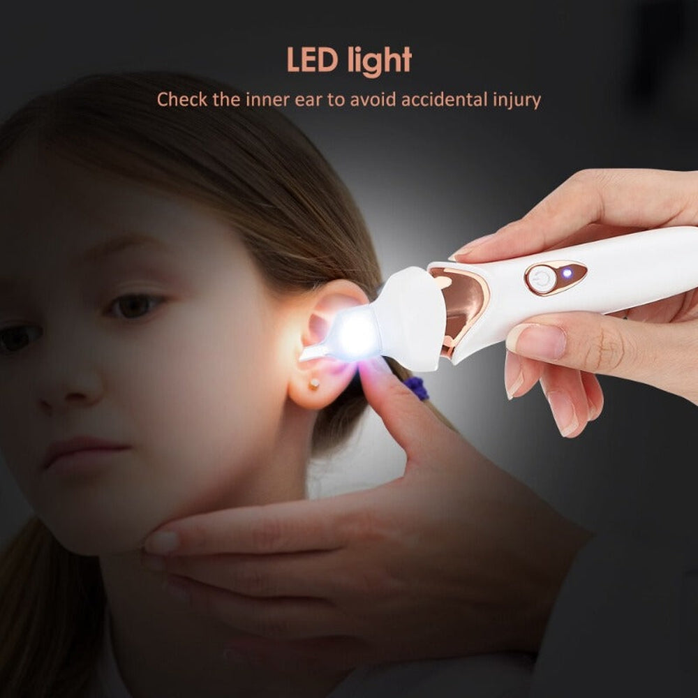 Gentle Ear Wax Suction for Home Use