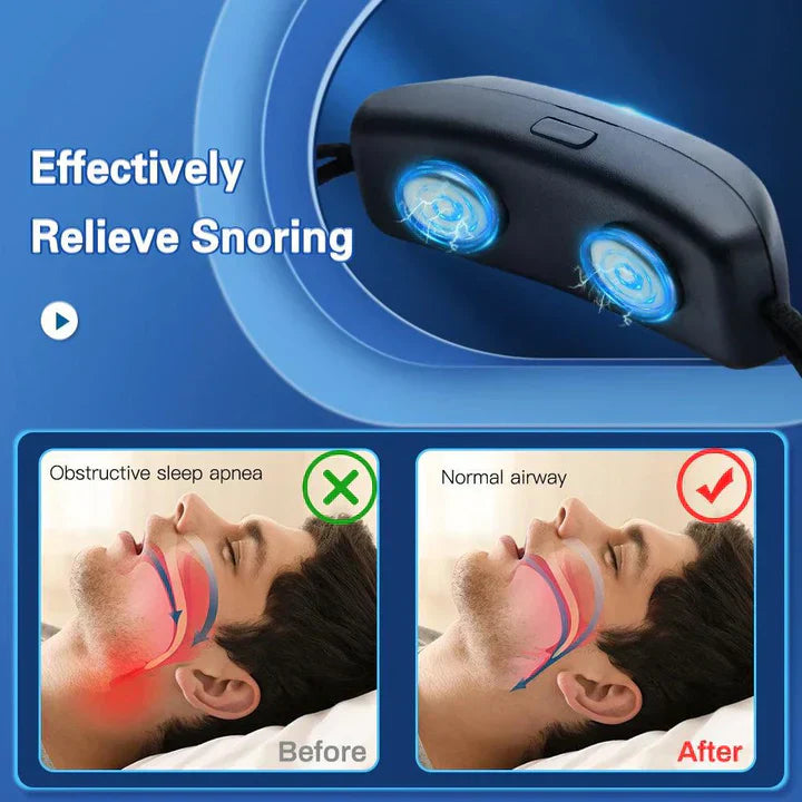 EMS Pulse Snore Stopper Device - Portable Sleep Aid