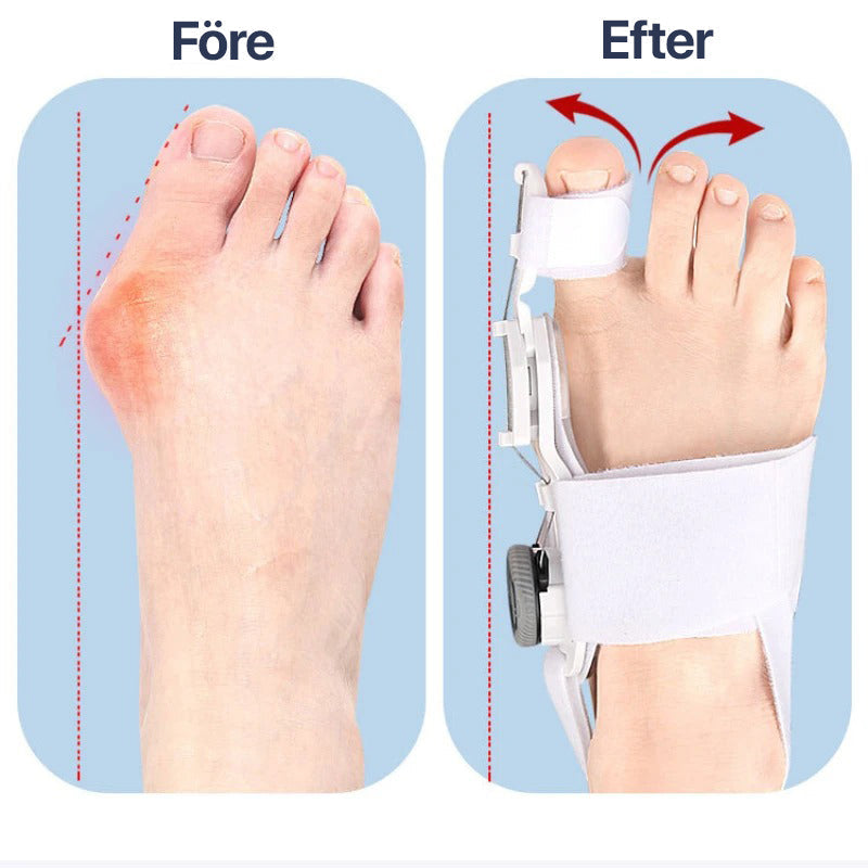 Adjustable Big Toe Straightener Brace for Hallux Valgus