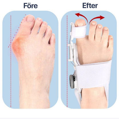 Adjustable Big Toe Straightener Brace for Hallux Valgus